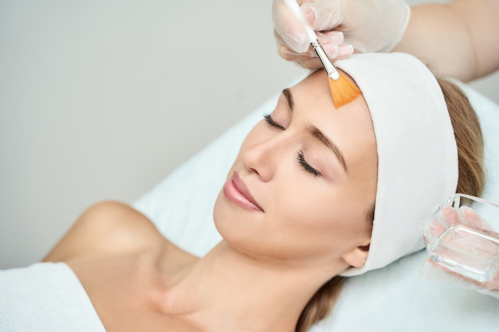 peeling chemiczny