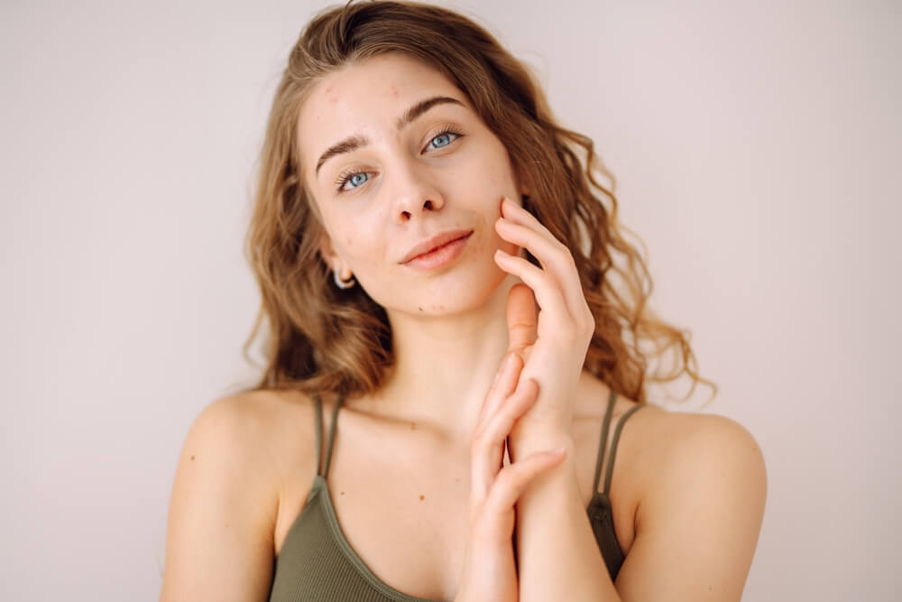 laserowe-usuwanie-naczynek